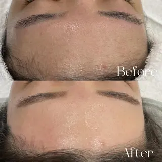 lazo MIYOのマツエク・マツパデザイン