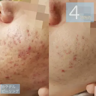 Lilyboo 池袋のエステ・リラクイメージ