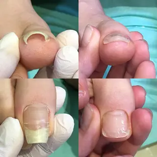 ネイル 東京巻き爪アカデミー所属・東京巻き爪 アカデミーのエステ・リラクイメージ