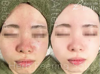 森 Belle目黒のエステ・リラクイメージ