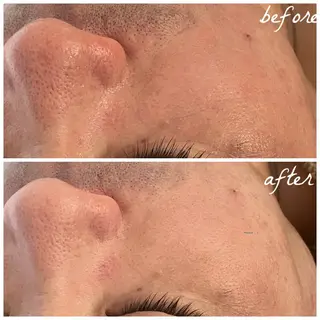 メンズ メナード岐阜茜部 杉浦のエステ・リラクイメージ