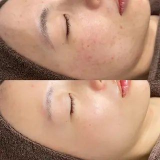 エステサロンTug高知駅前店所属・Tug 高知駅前店/ NANAMI🌐のエステ・リラクイメージ