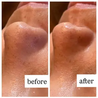 肌質改善専門 ハーブ /毛穴洗浄 リエイトのエステ・リラクイメージ