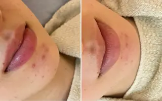 肌質改善 KALANCHOEのエステ・リラクイメージ