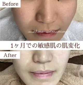 都度払い 肌質改善専門サロンのエステ・リラクイメージ