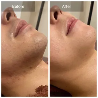 メンズ Beauty  Studio CARO所属・ビューティースタジオ カーロのその他イメージ