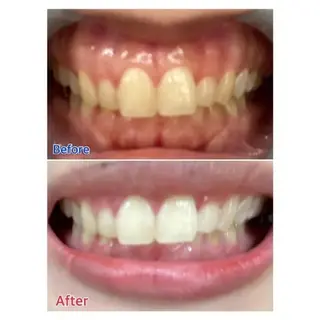 M渋谷店所属・M渋谷 ホワイトニングのエステ・リラクイメージ