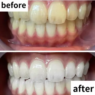 LBSホワイトニング 🌐渋谷店 河内のエステ・リラクイメージ