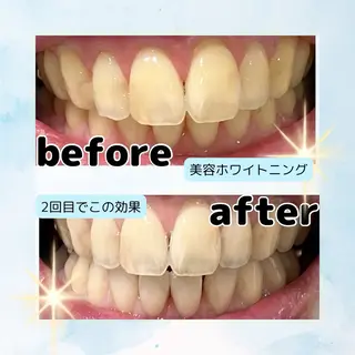 ホワイトニングサロン Soleilのその他イメージ