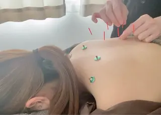 美容鍼＆鍼灸サロン 鍼Glitter.所属・鍼グリッター 仁科陽花のエステ・リラクイメージ