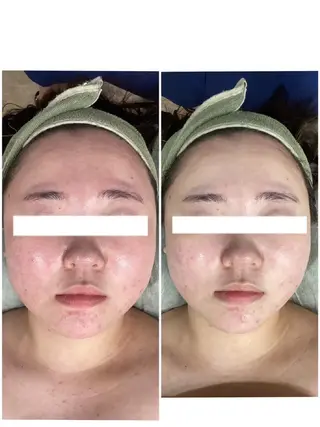 レイビス盛岡店 ♡吉田♡のエステ・リラクイメージ