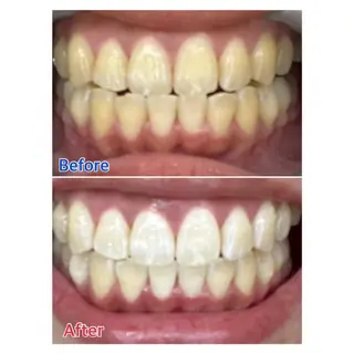 MBEAUTYSALON 千葉店・京成大久保所属・Melty 輝のその他イメージ