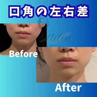 💎小顔サロン アリリン銀座💎のエステ・リラクイメージ