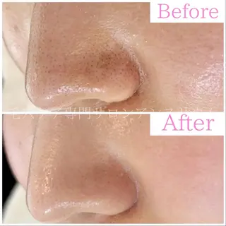 毛穴ケア専門サロンアンスリウム所属・茨城土浦 つくば毛穴 ケア専門サロンのエステ・リラクイメージ