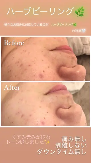 ララ/ハーブ メゾンリュバンのエステ・リラクイメージ