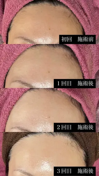 脱毛和みサロン新茶屋所属・脱毛和みサロン新茶屋 ひろみ（女性専用）のエステ・リラクイメージ