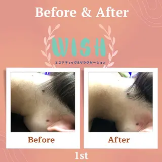 WISH 美肌脱毛のプロ！須藤のエステ・リラクイメージ
