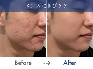 メンズ メンズオーシャンブルー福岡店所属・NOZOMI/メンズ オーシャンブルーのエステ・リラクイメージ