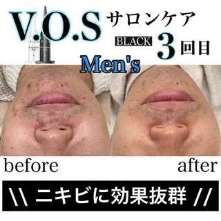 laluna saki...のその他イメージ