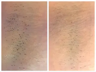 セレーネボーテプラス所属・セレーネボーテプラス ローマピンク福岡のエステ・リラクイメージ