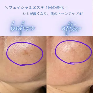 肌管理エステサロン｜ Connect ゆいのエステ・リラクイメージ