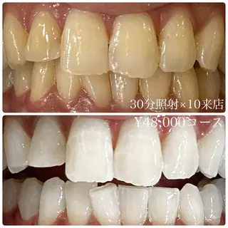 メンズ ホワイトニングルーム　川崎店所属・ホワイトニング ルーム　川崎店のその他イメージ