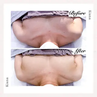 【バスト専門店 】 Kiana のエステ・リラクイメージ