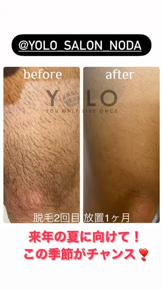 YOLO 梅郷店所属・YOLO痩身/脱毛 🌼MARI🌼のエステ・リラクイメージ