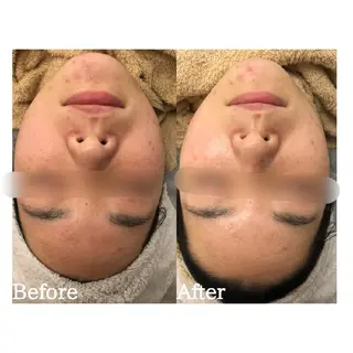 肌質改善サロン BestBelleのエステ・リラクイメージ