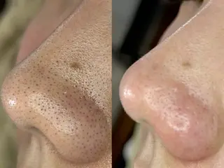 美肌脱毛&毛穴専門 Nico🐰ྀི♡のエステ・リラクイメージ