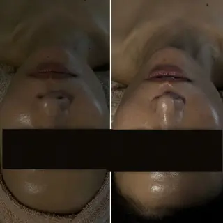 FLORALNOTE所属・ReCell 肌管理のエステ・リラクイメージ