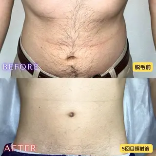 メンズ 都度払い専門　脱毛サロンHYGIENE BEAUTY ROOM 19B 仙台駅前東口店所属・脱毛サロン 19B(毛利)のエステ・リラクイメージ