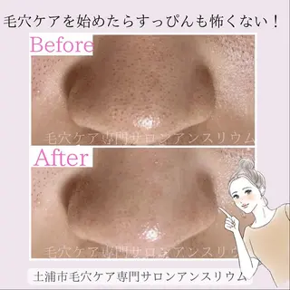 毛穴ケア専門サロンアンスリウム所属・茨城土浦 つくば毛穴 ケア専門サロンのエステ・リラクイメージ