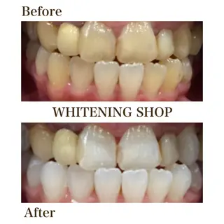 ホワイトニング ショップ川越店のエステ・リラクイメージ