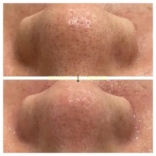 ビューティー ミロワールのエステ・リラクイメージ