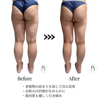 Plus One Beauty所属・【新大阪】痩身/小顔 美肌フェイシャルのエステ・リラクイメージ