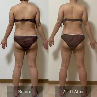 未病ケアサロン EMINY所属・未病ケアサロン EMINY☺︎勝俣のエステ・リラクイメージ