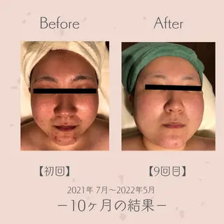 エステ＆美肌脱毛 ココサロ倉敷店のエステ・リラクイメージ