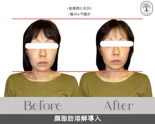 ヘッドスパ・小顔矯正　十色　横浜所属・ヘッドスパ・小顔矯正 十色　横浜のエステ・リラクイメージ