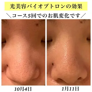 Bellesthe （ベルエステ）のエステ・リラクイメージ