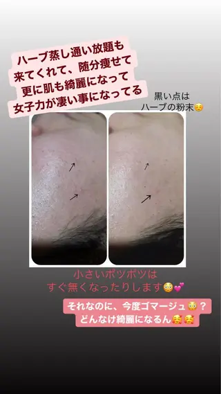 【足圧】鬼👹リンパ 身体整うサロンのエステ・リラクイメージ