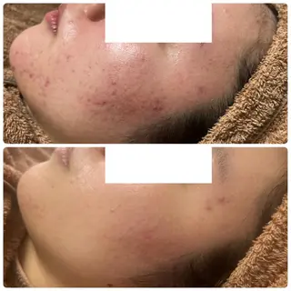 beautysalon LINO所属・平日昼間限定★ 全メニュ¥6600のエステ・リラクイメージ