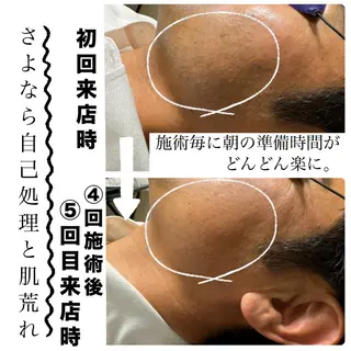 メンズ メンズ脱毛サロン Le falcoのエステ・リラクイメージ