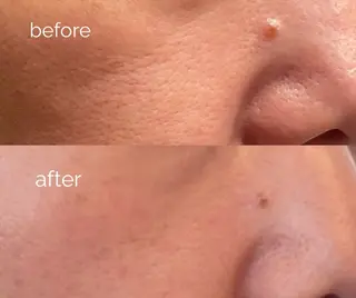 毛穴ケア専門サロン m&uのエステ・リラクイメージ