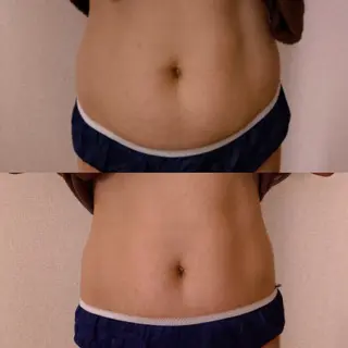 小顔フェイシャル・痩身専門SalonKeiko所属・大内 圭子のエステ・リラクイメージ