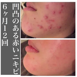 ミディアム カラー パーマ ヘアアレンジ メンズ キッズ ネイル マツエク・マツパ ニキビ・肌質改善専門 ♡人生が変わるサロンのエステ・リラクイメージ