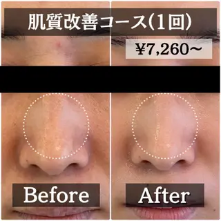 【肌質改善・リフトアップ専門店】セラピックエステ美極所属・羽賀 茉衣子のエステ・リラクイメージ