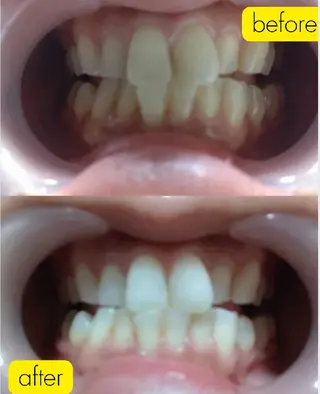 はなえみの森所属・上戸 千瑞のエステ・リラクイメージ