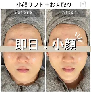 salon de perfectionのエステ・リラクイメージ