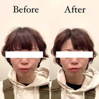 Hari Lounge恵比寿所属・chika🦋 ハリラウンジ恵比寿のエステ・リラクイメージ